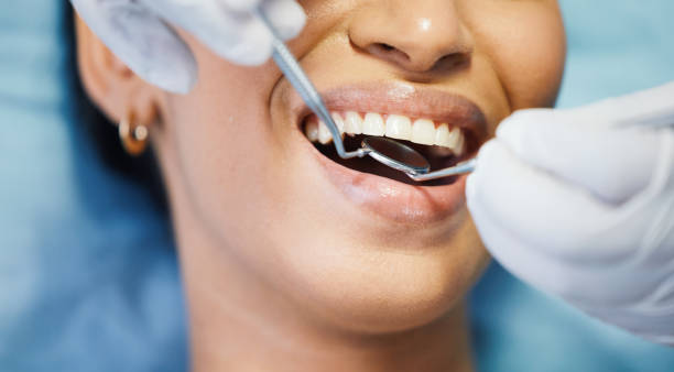 Best Chipped Tooth Repair Near Me  in King Arthur Park, MT