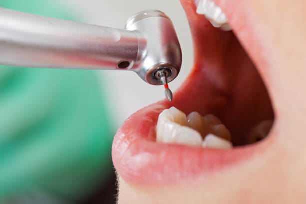 Best Cracked Tooth Emergency Dentist  in King Arthur Park, MT